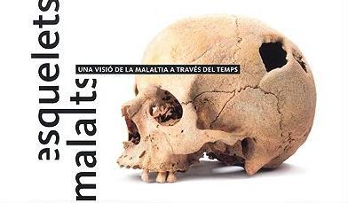 Esqueletos enfermos. Una visión de la enfermedad a través del tiempo Esqueletos enfermos. Una visión de la enfermedad a través del tiempo